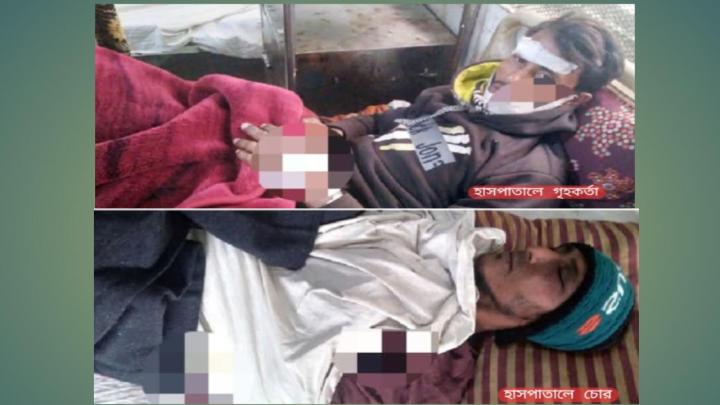 মধুখালীতে চোরের কামড়ে গৃহকর্তা আহত, গৃহকর্তা ও চোর হাসপাতালে